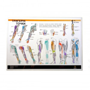 Таблиця тригерних точок Медіспорт